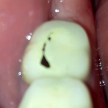 Sex after vaginal surgery Passed out masturbate