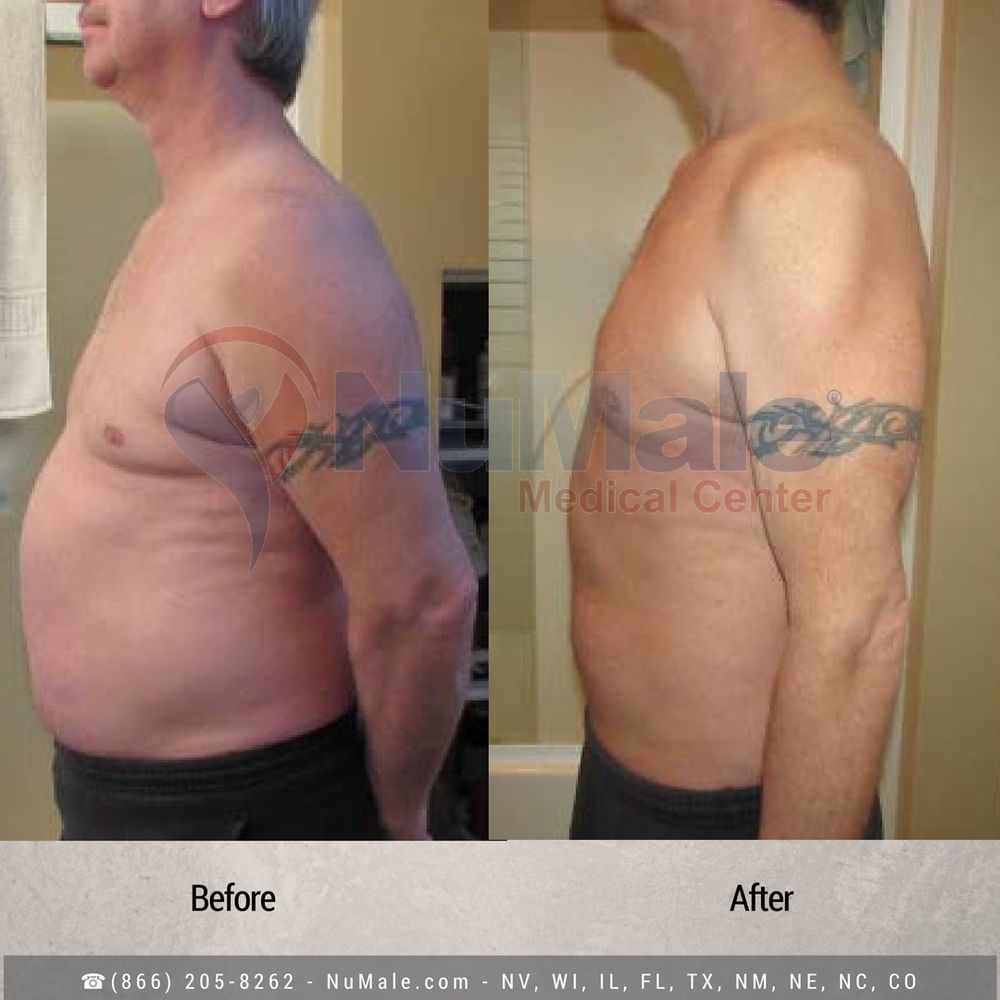 NuMale Medical Center - Charlotte