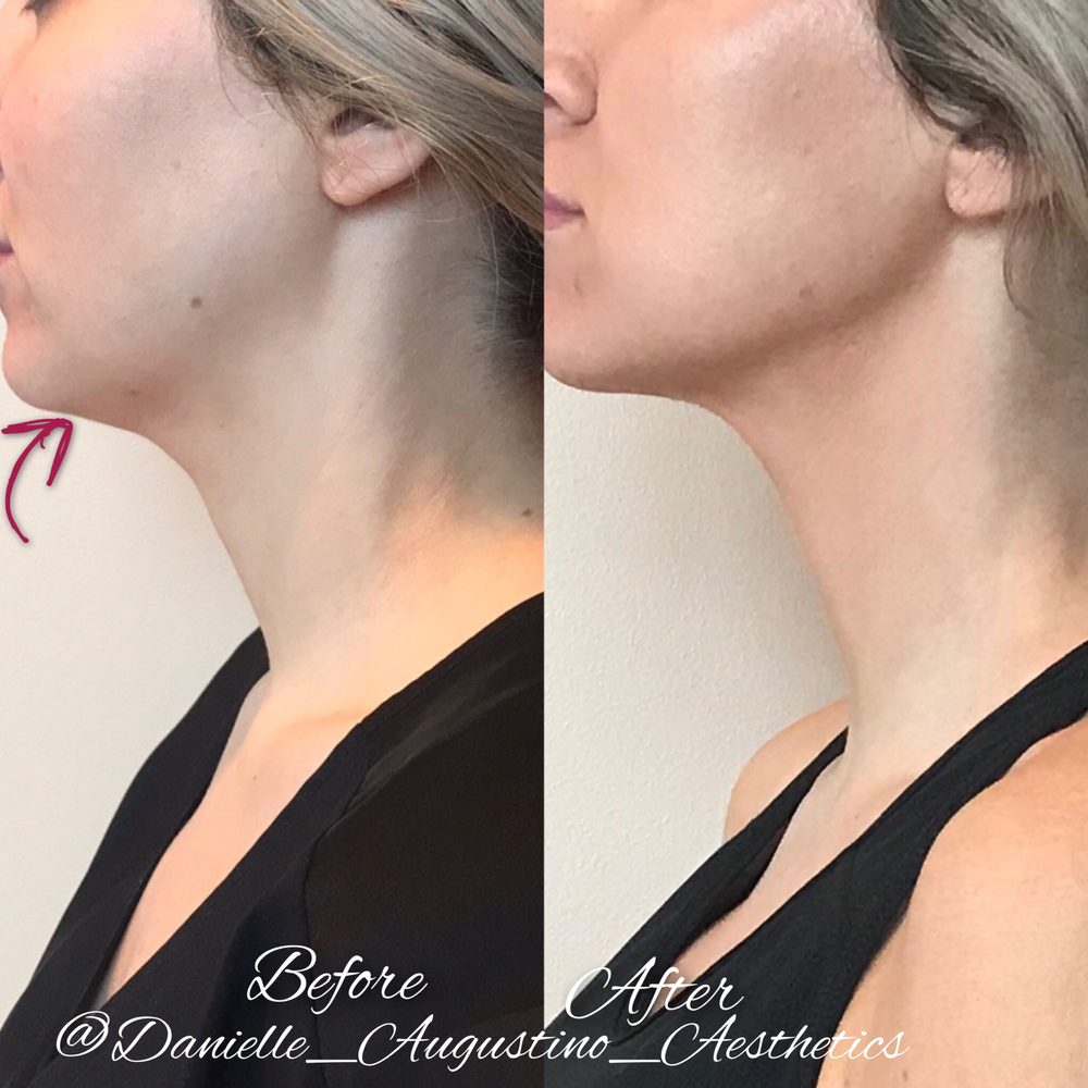 Inova Medical Aesthetics & Spa