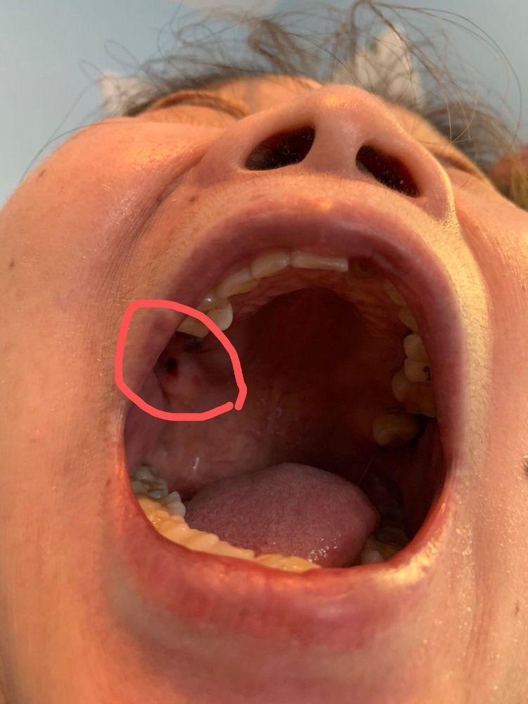 Accellent Dental