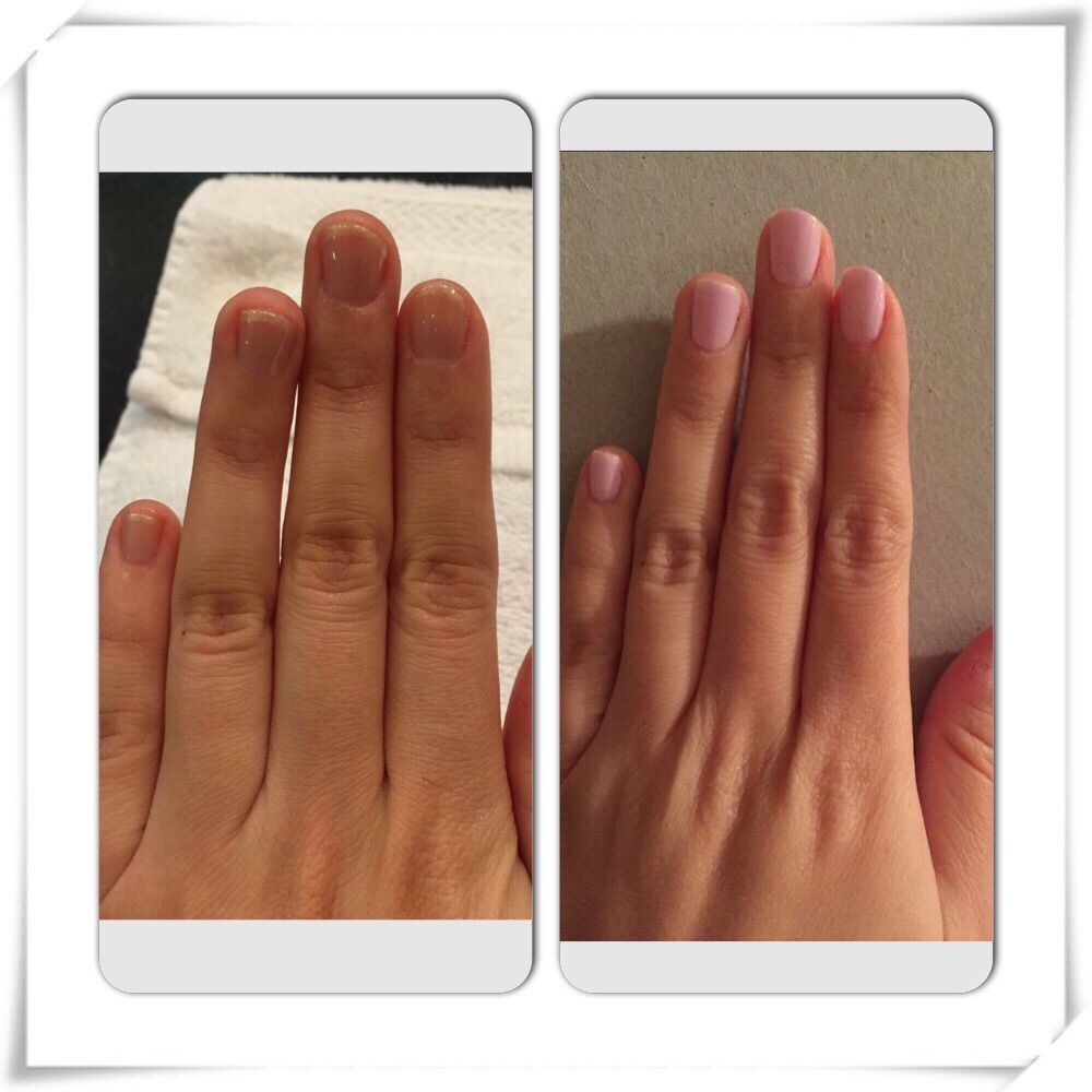 Nails Before And After Parlor 836 S Magic Yelp Photo Of Parlor 836 Chicago Il United States Nails Before And After