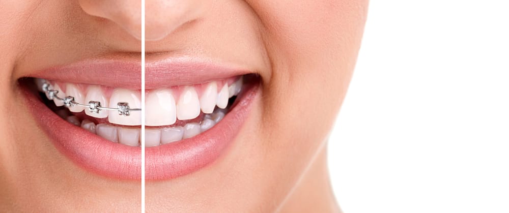 SBH Orthodontics - Toronto - Orthodontists - 315 Spadina ...