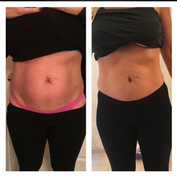 Weight loss while teething photo 6