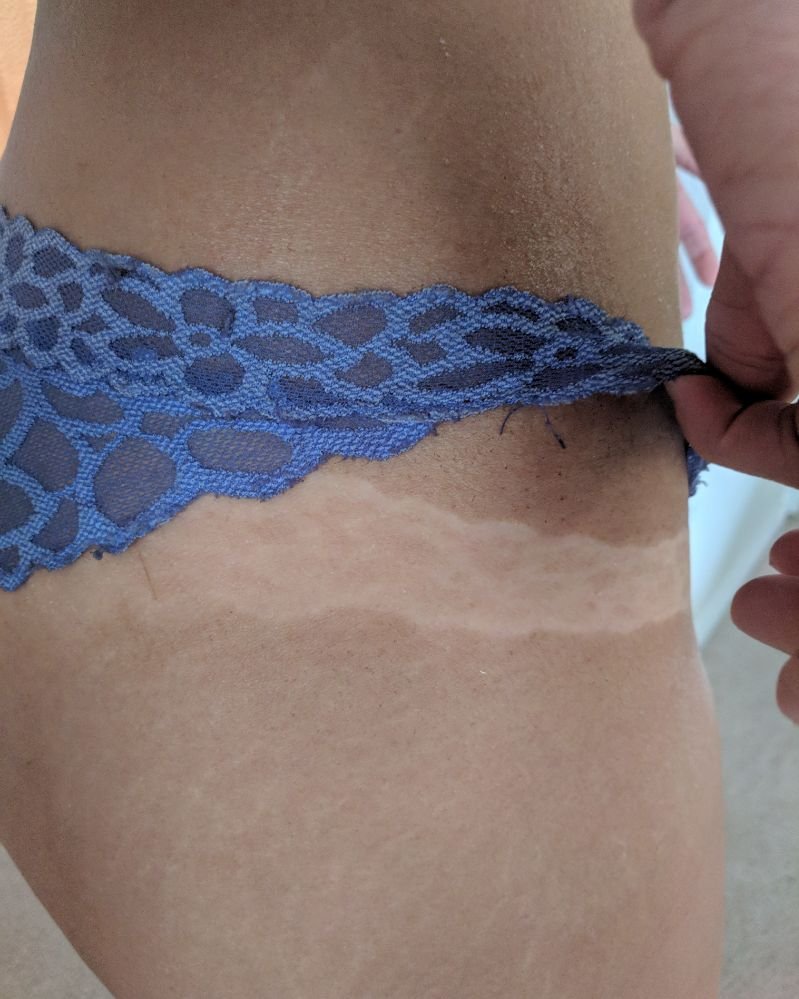 O