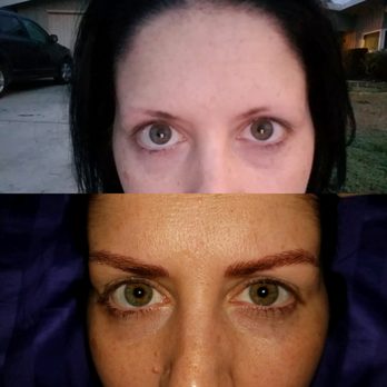 Skin Care Clinic Huntington Beach Ca Skin Care Clinic Huntington Beach Ca