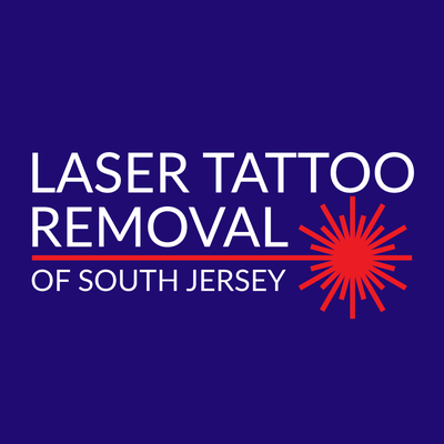 laser my ink tattoo removal south jersey tattoo removal 100 laser my ink tattoo removal south jersey tattoo removal 100