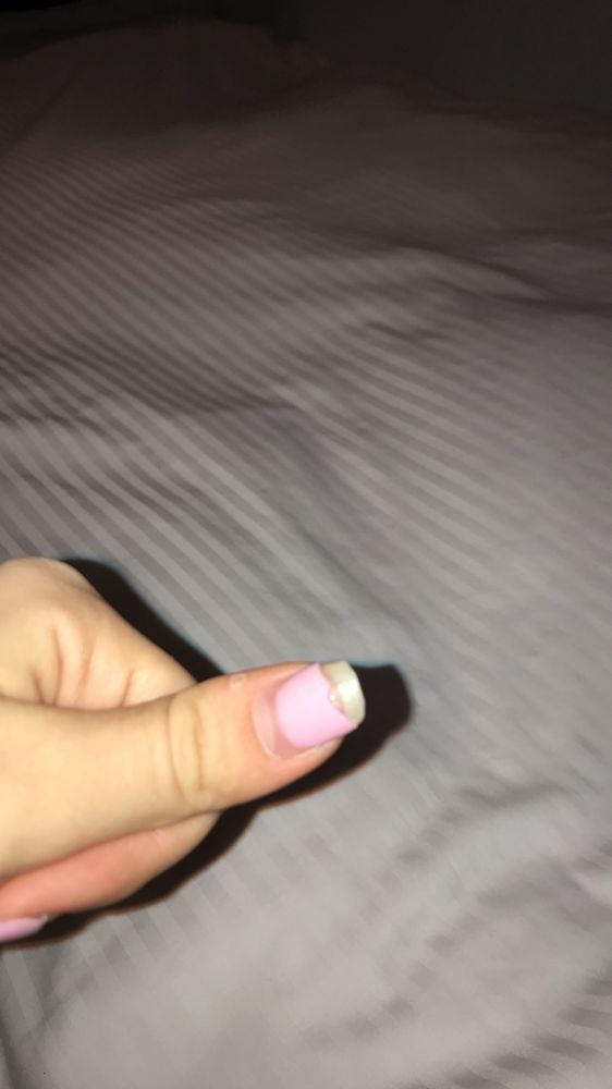 My Half Broken Nail Yelp Photo Of Rose Nails Spa Vancouver Bc Canada My Half Broken