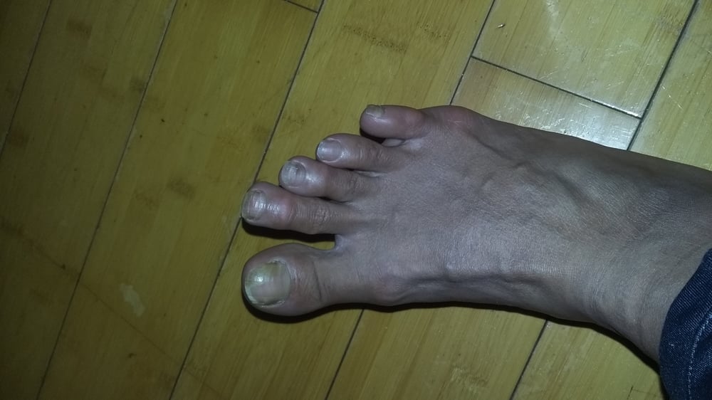 O