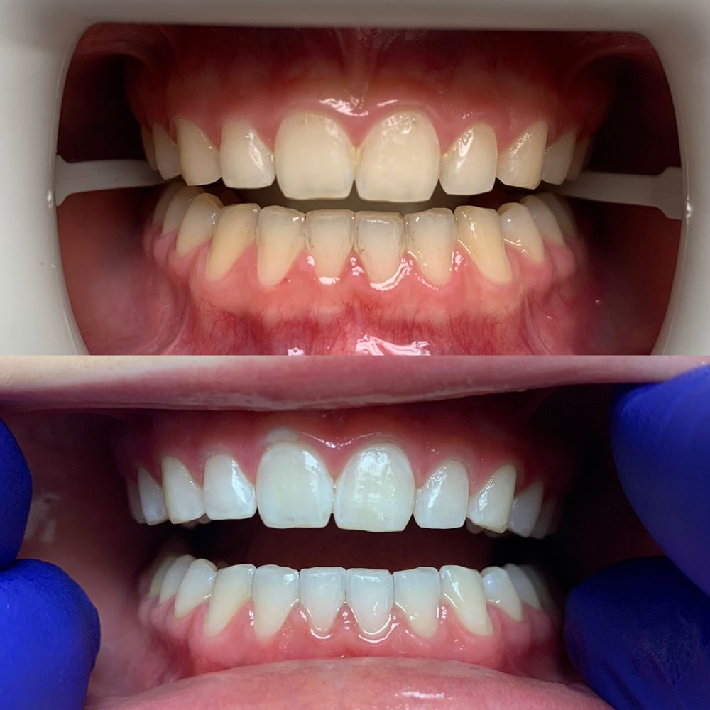 image of business Vestavia Smiles