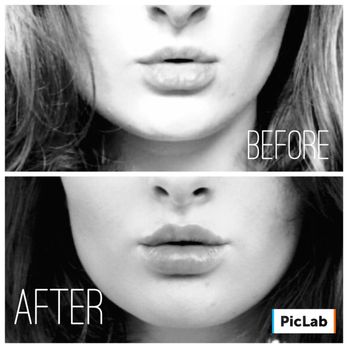 It S A Secret Med Spa Dallas It S A Secret Med Spa Dallas