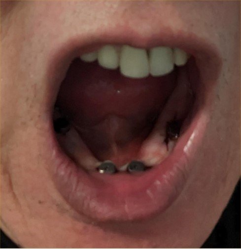 Podlesh Scott & Oral Surgeon