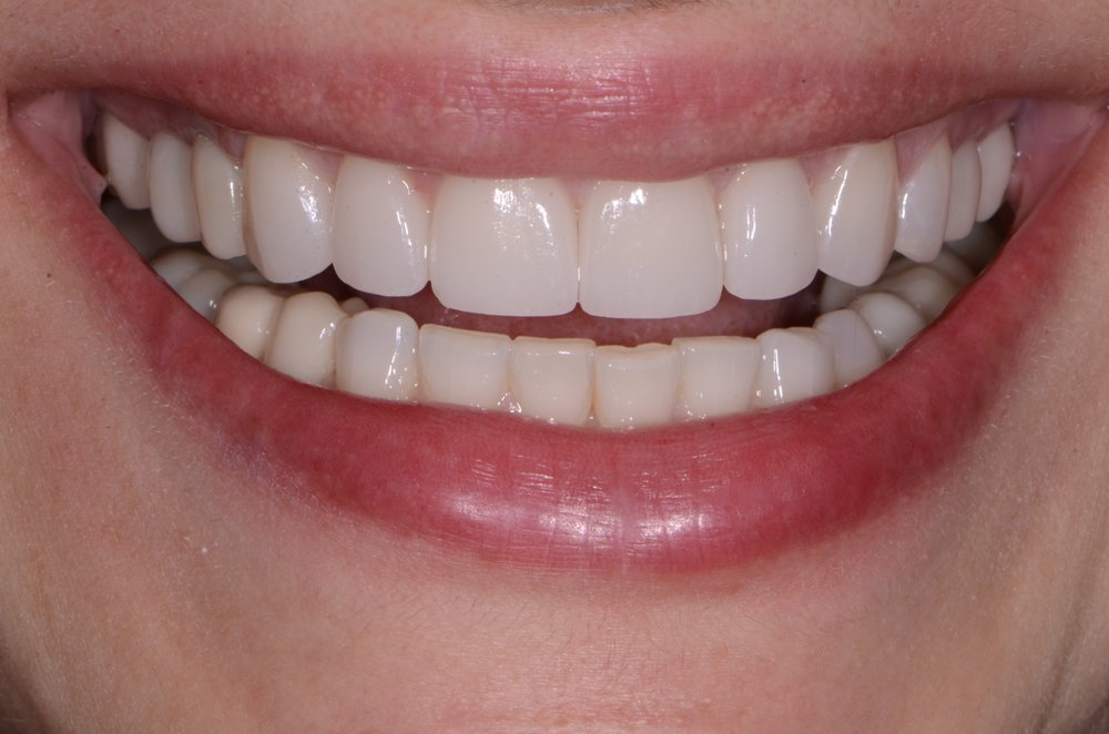 image of business Designer Smiles of Colorado