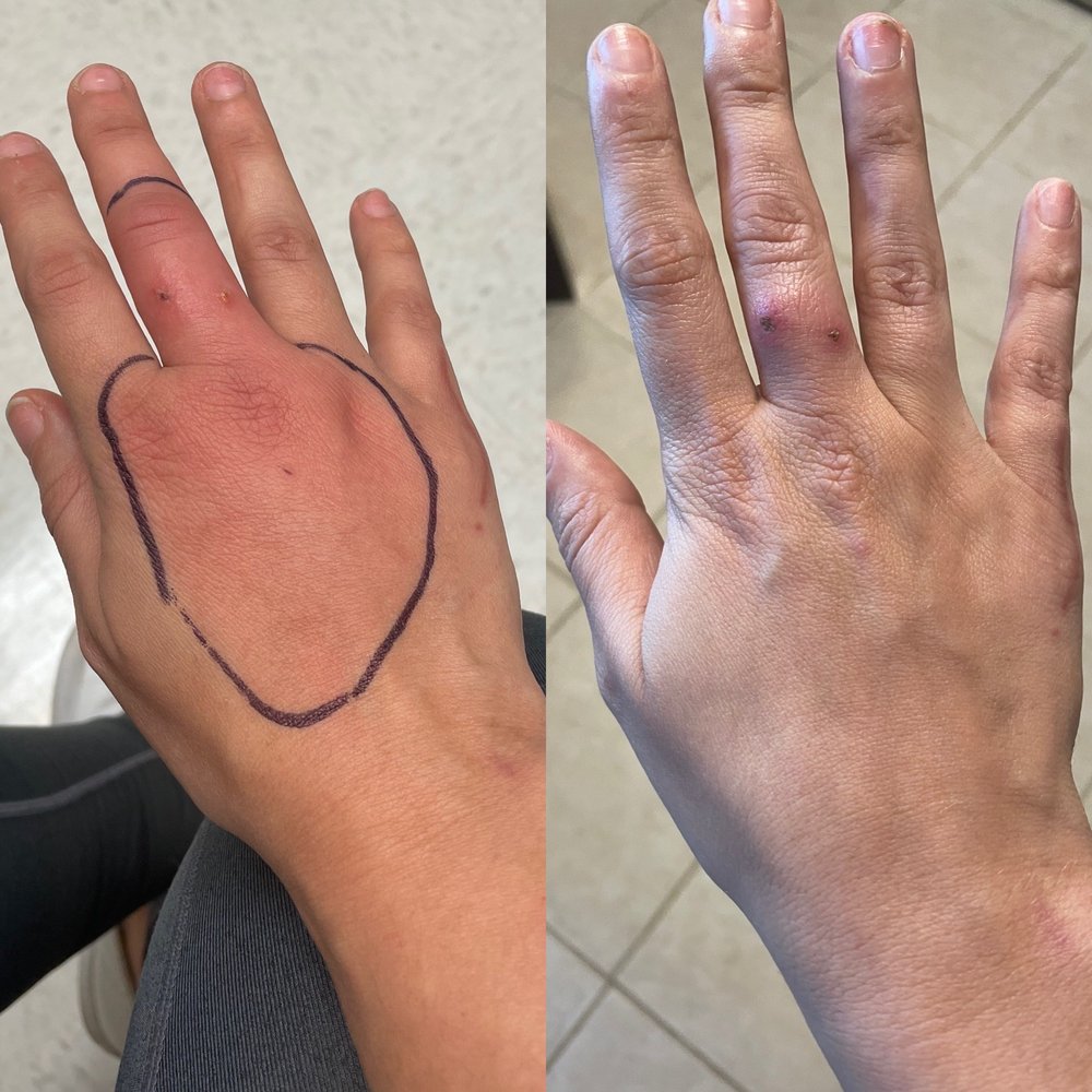 MedPost Urgent Care of Rowlett