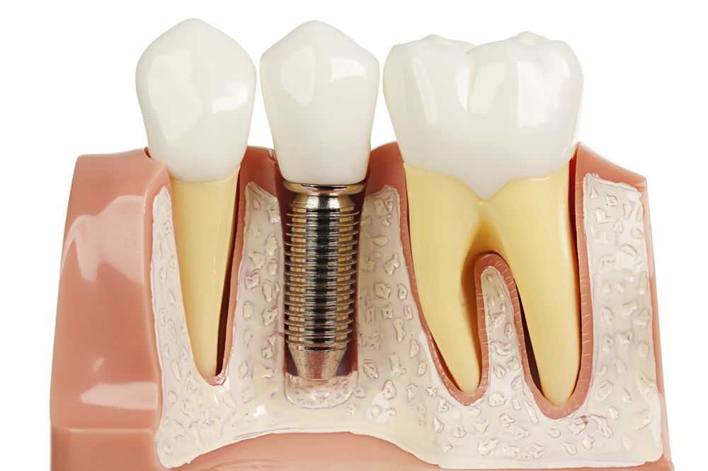 image of business Advance Dental Care