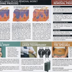 Photo Of Tattoo Removal Center Torrance Ca United States How Does It Photo Of Tattoo Removal Center Torrance Ca United States How Does It