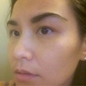 Marc Dauer Md 72 Photos 26 Reviews Cosmetic Surgeons 2080 Photo Of Marc Dauer Md Los Angeles Ca United States My