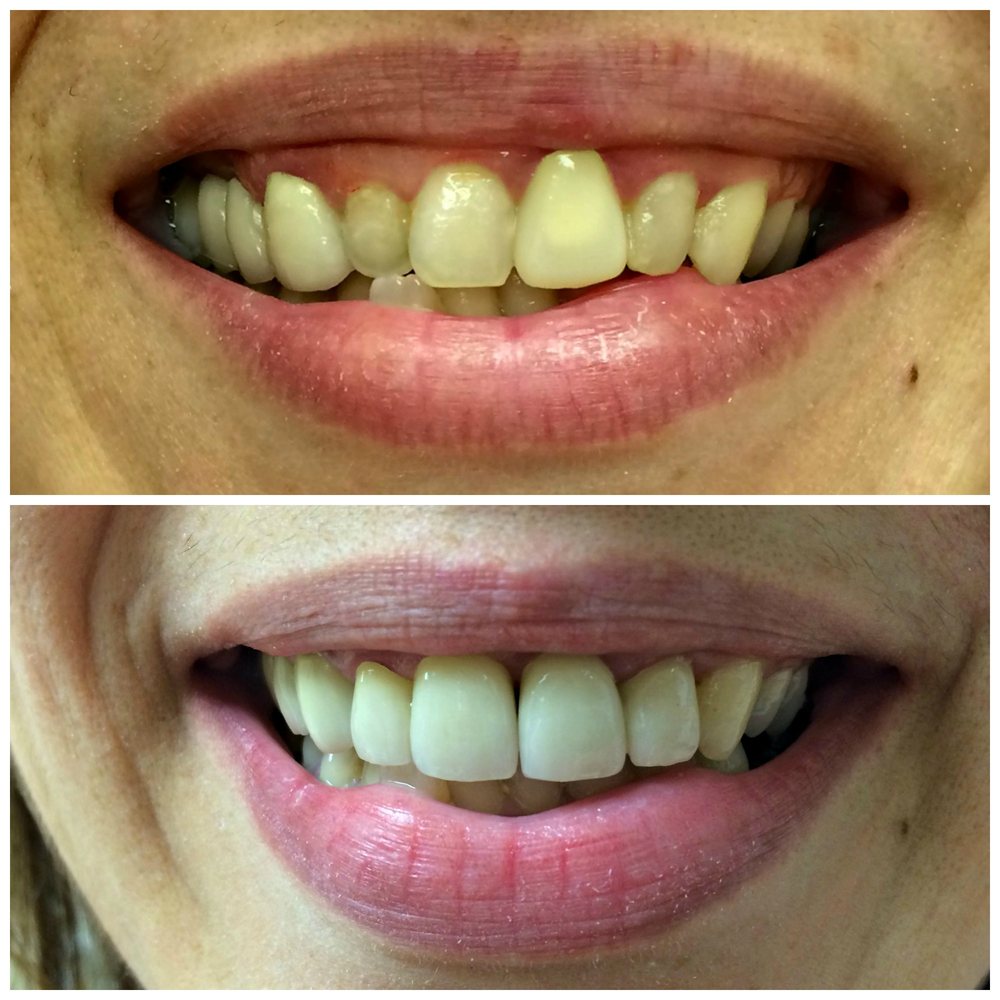 Kearny Family Health Center 29 Photos General Dentistry 65 Kearny