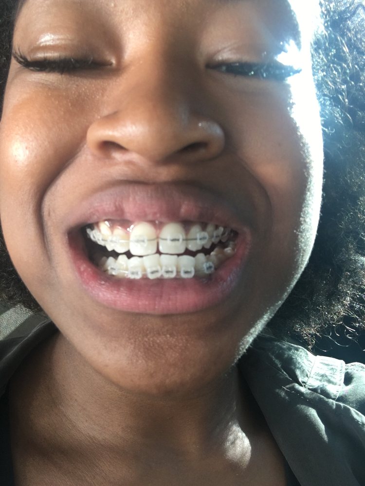 Comfort Dental Braces Of Westminster Orthodontics 8113 W 94th Ave Westminster Co 80021