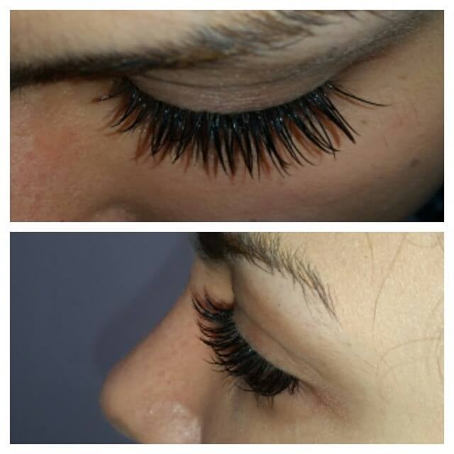 Mila Laser Clinic