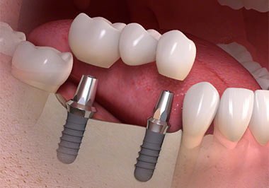 image of business Bella Dental Services
