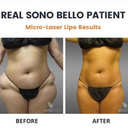 Will you lose weight on zoloft picture 4
