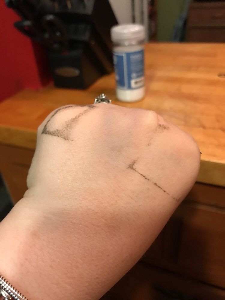 Chippenham Hospital 15 Photos & 20 Reviews Hospitals 7101 Jahnke