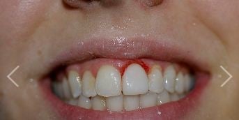 image of business James Glennon Jr, DDS - Glennon Dental