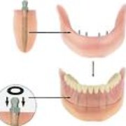 3 Stone Dental 21 Photos Cosmetic Dentists 367 Washington St Photo Of 3 Stone Dental Claremont Nh United States