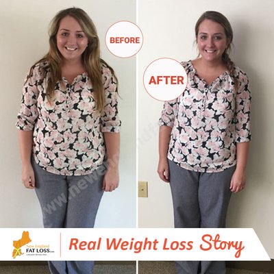 How to get motivated enough to lose weight picture 3