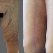 A diet plan that actually works with hypothyroidism image 7