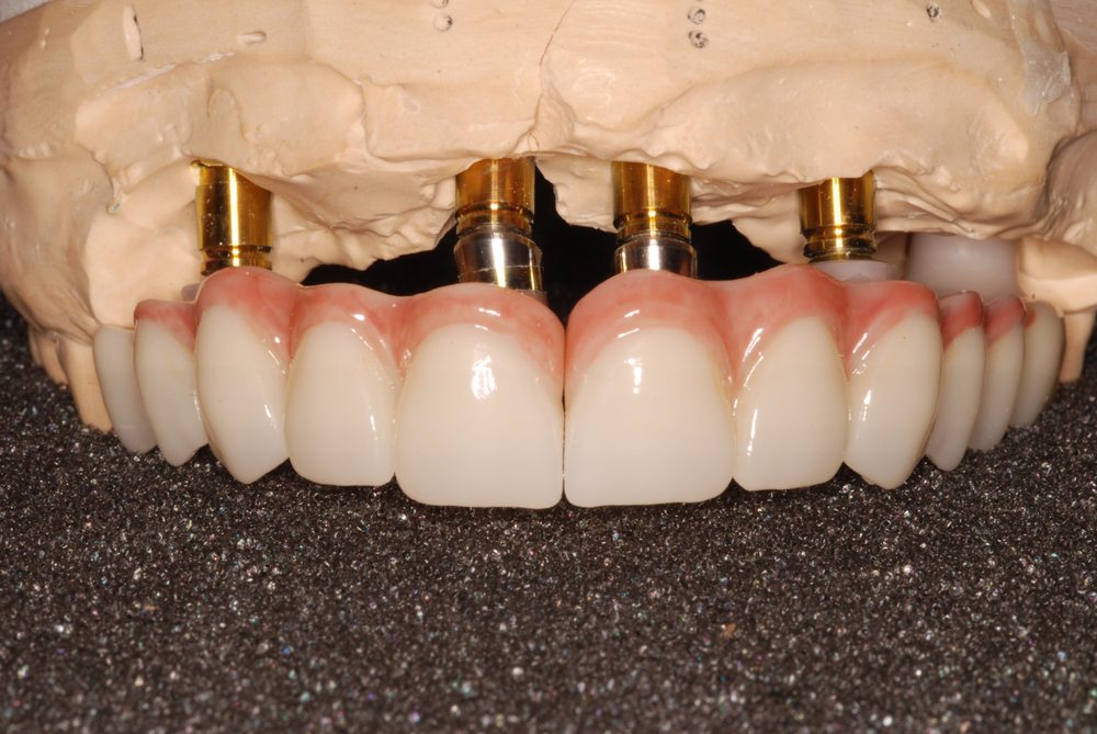 image of business Becker Dental