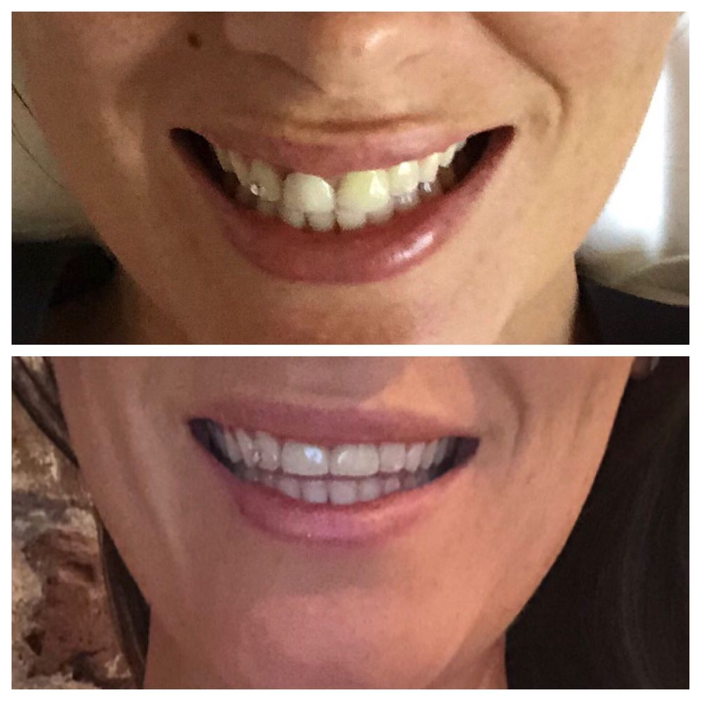image of business New Day Dentistry Centennial | Dr. Amanda Hudec, DMD