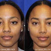 jay calvert md 53 photos 36 reviews cosmetic surgeons 120 s jay calvert md