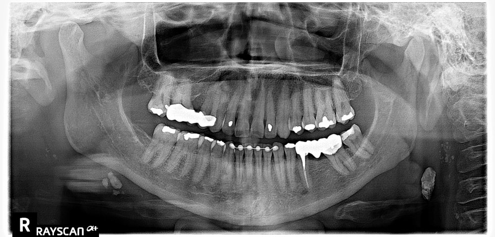 image of business Sunrise Dental - Wenatchee