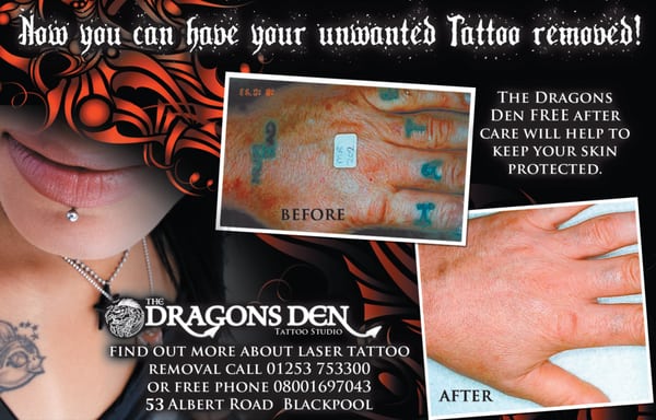 the dragons den laser tattoo removal tattoo 53 albert rd the dragons den laser tattoo removal tattoo 53 albert rd
