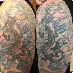 Photos for Hindsight Tattoo Removal - Yelp
