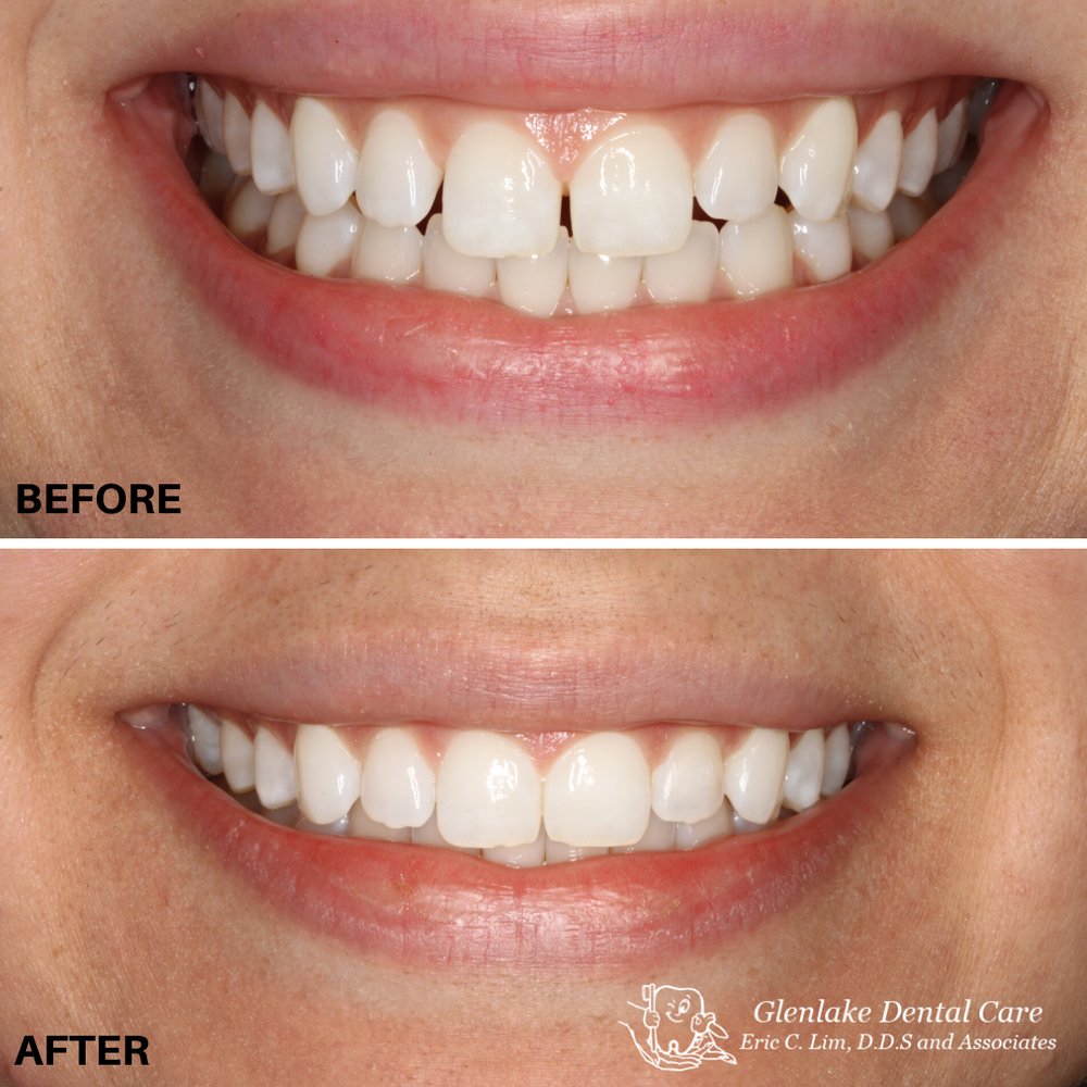 image of business Glenlake Dental Care