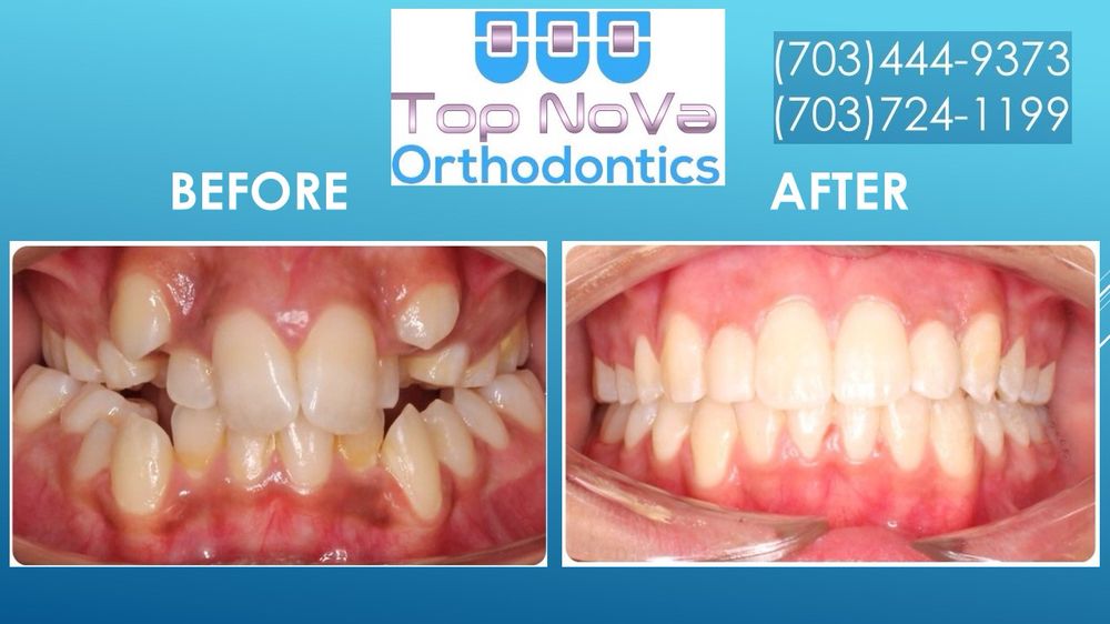 Top NoVa Orthodontics