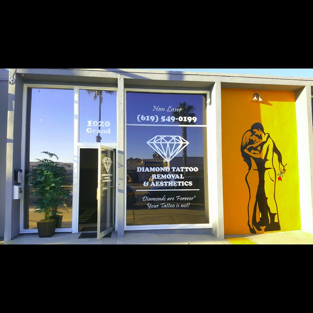 diamond tattoo removal and aesthetics non laser tattoo removal diamond tattoo removal and aesthetics non laser tattoo removal