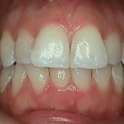 Presidio Dental - 11 Photos & 52 Reviews - Cosmetic ...