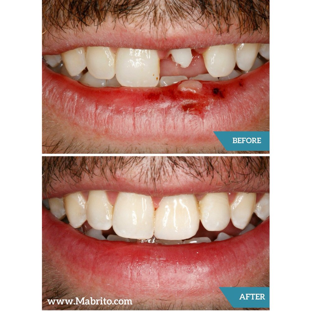 image of business Mabrito Dental