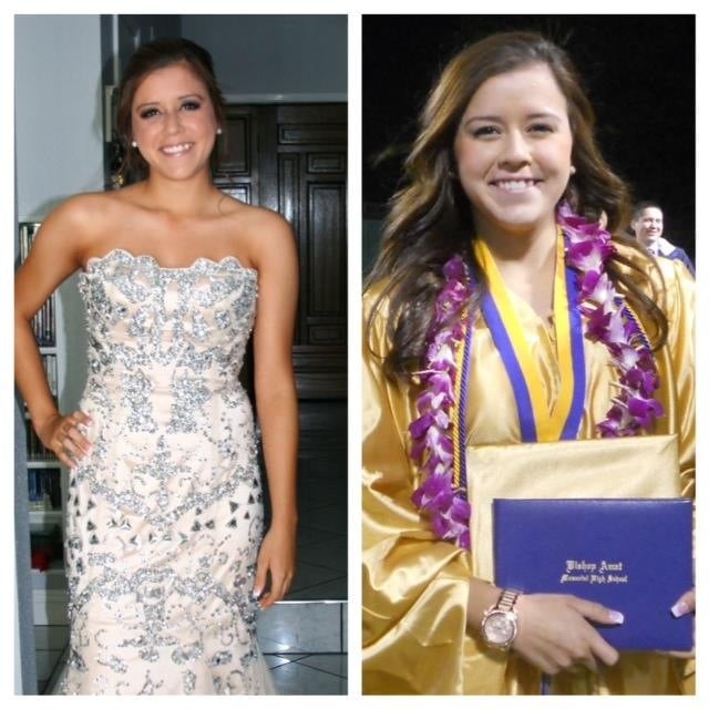 Blanche Teeth Whitening - 132 Photos &amp; 71 Reviews - Teeth Whitening 