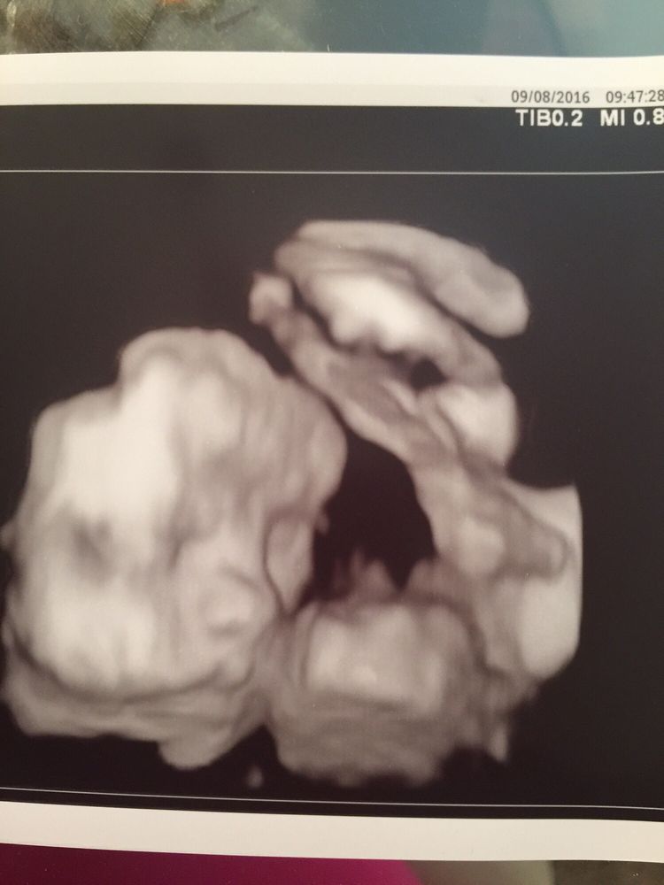 Maternal Fetal Associates