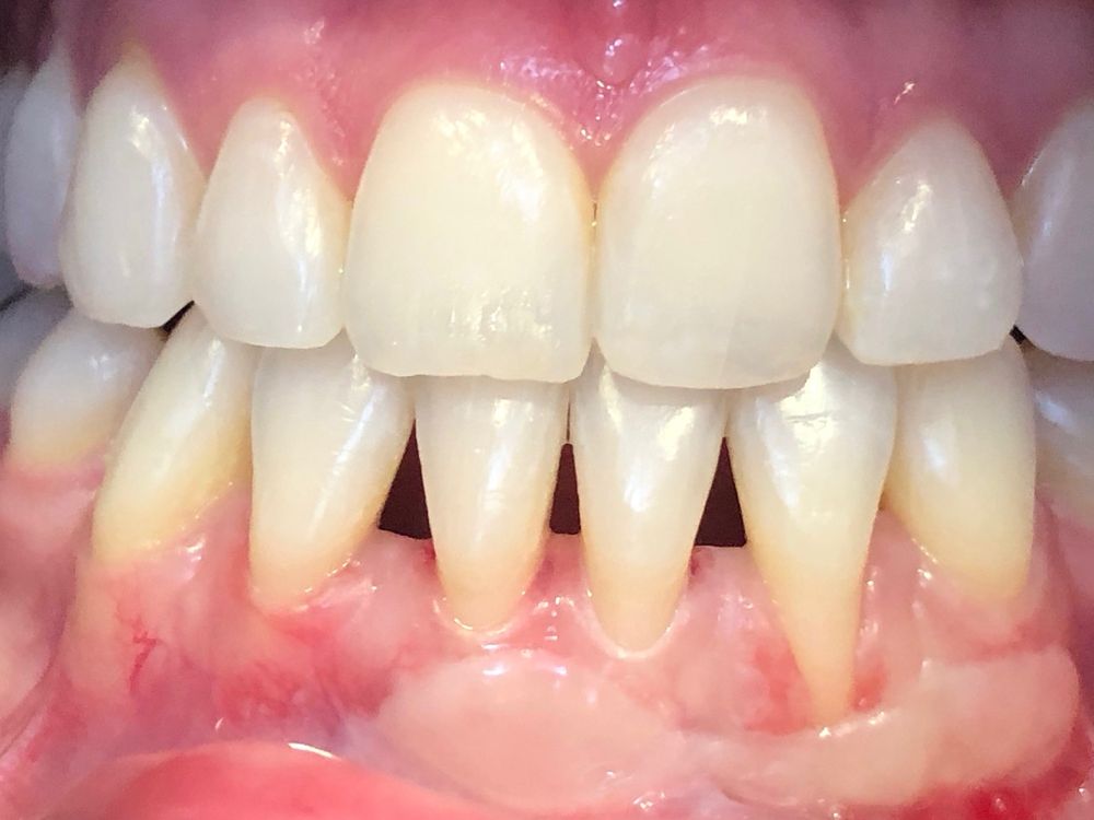 image of business Kristine S Yoshida, DDS - Summit Dental