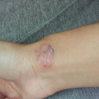 way gone laser tattoo removal 121 photos u0026 76 reviews tattoo way gone laser tattoo removal 121 photos u0026 76 reviews tattoo
