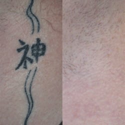 perfect skin laser center 10 photos u0026 33 reviews cosmetic perfect skin laser center 10 photos u0026 33 reviews cosmetic