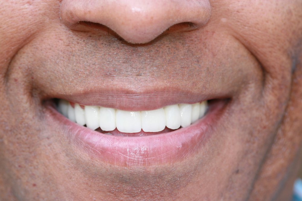 image of business Dental Illusions: Basil Moukarim, DDS