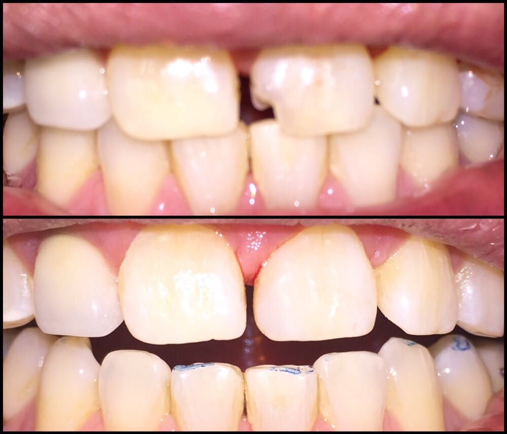image of business David Kroner, DDS - KADI Dental