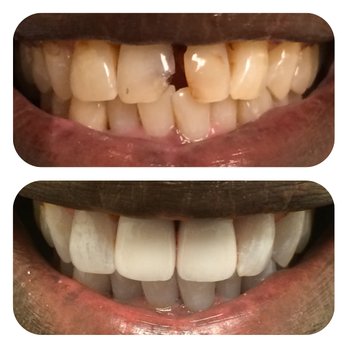 Mint Dentistry 25 Photos \u0026 50 Reviews Cosmetic Dentists 20046 Ventura Blvd, Woodland Hills Mint Dentistry 25 Photos \u0026 50 Reviews Cosmetic Dentists 20046 Ventura Blvd, Woodland Hills