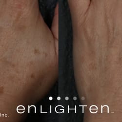 enlighten aesthetic of cleveland skin care 5187 mayfield rd enlighten aesthetic of cleveland skin care 5187 mayfield rd